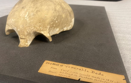 Rediscovered cast of St Bede’s skull brought to Durham Cathedral Museum after more than 190 years